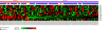 Overexpression of Pyruvate Dehydrogenase Kinase-3 Predicts Poor Prognosis in Urothelial Carcinoma